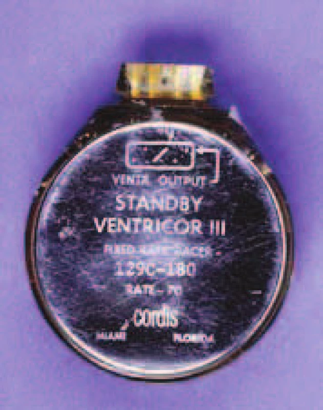 První „standby“ kardiostimulátor firmy Cordis Corp. pracující v režimu VVT. Název Ventricor III-129C byl brzy změněn na Ectocor. Přístroj byl vybaven 5 zinko-rtuťovými články a byl vyráběn v letech 1965–1967.