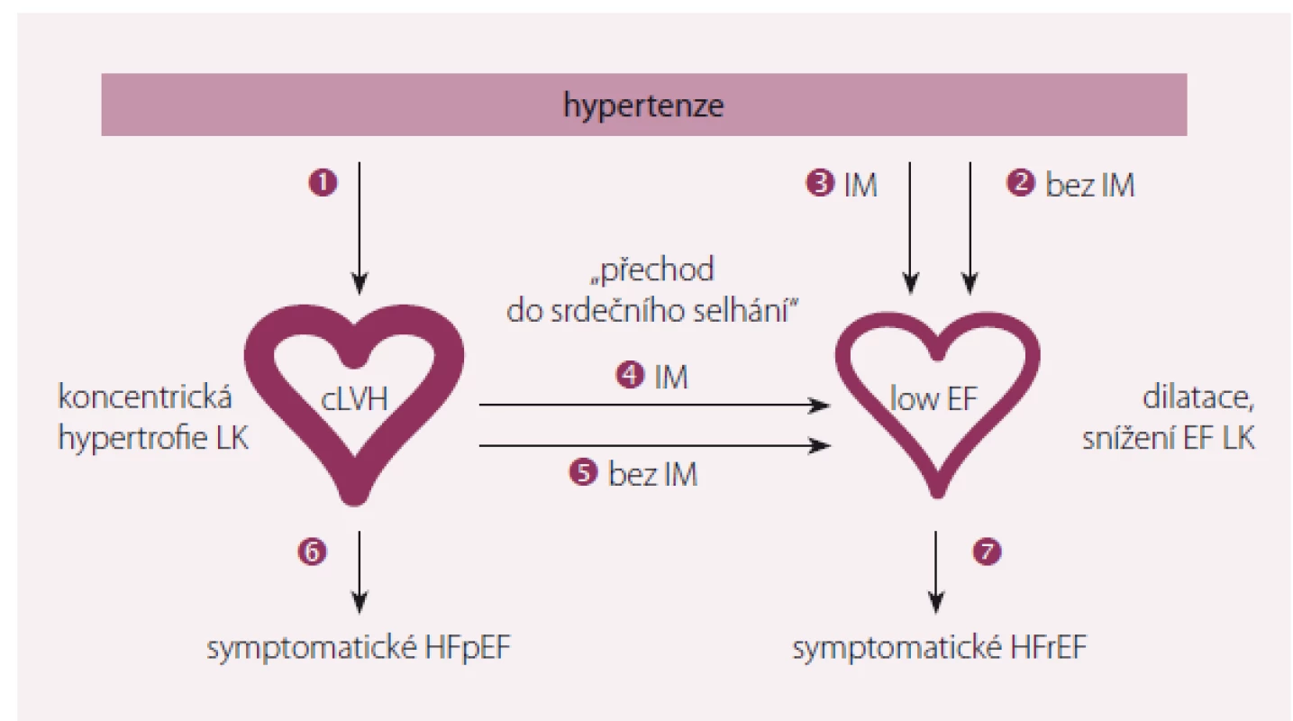 Možné cesty vývoje hypertenze k srdečnímu selhání.