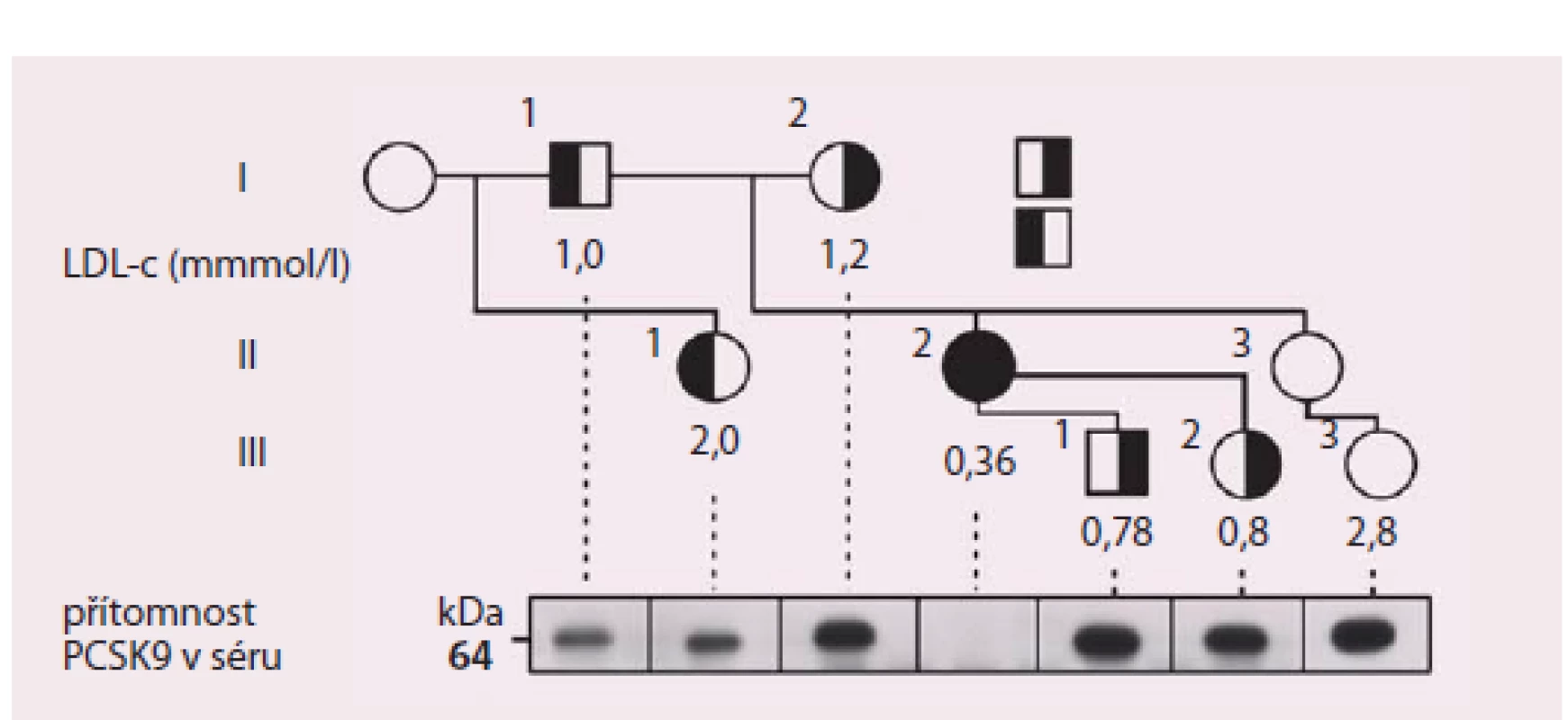 Rodokmen probandky (označena šipkou) s dvěma mutacemi snižujícími funkci PCSKS9.
