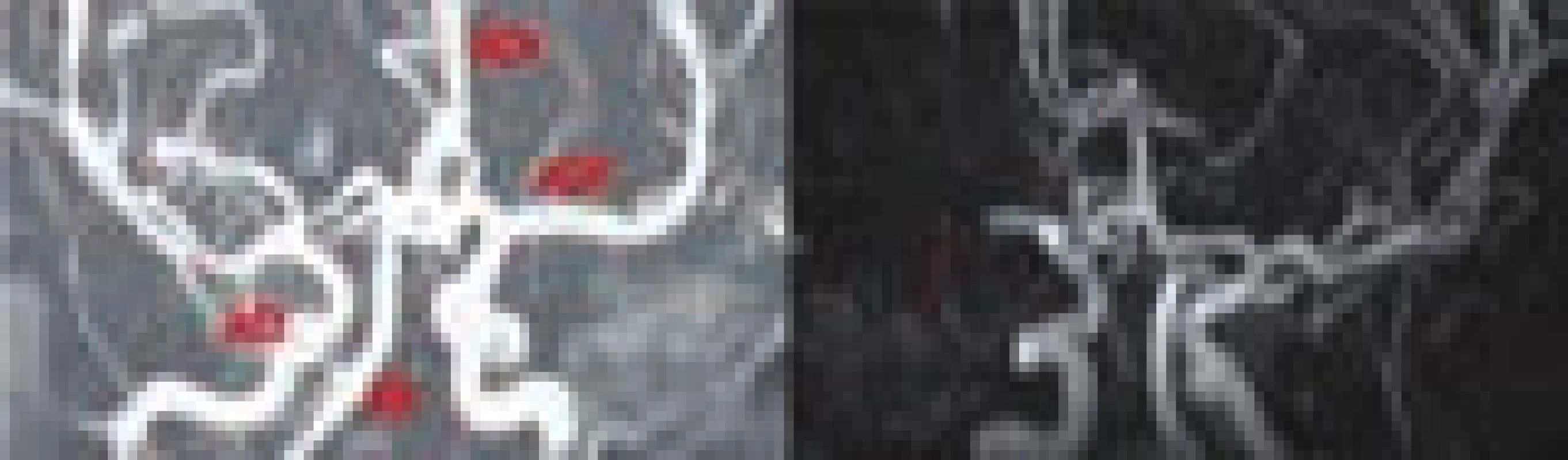 Intrakraniální MR angiografie, na prvním snímku normální nález (ACM – a. cerebri media, ACA – a. cerebri anterior, ACI – a. carotis interna, AB – a. basilaris), na druhém snímku šipkou označena okluze ACM.