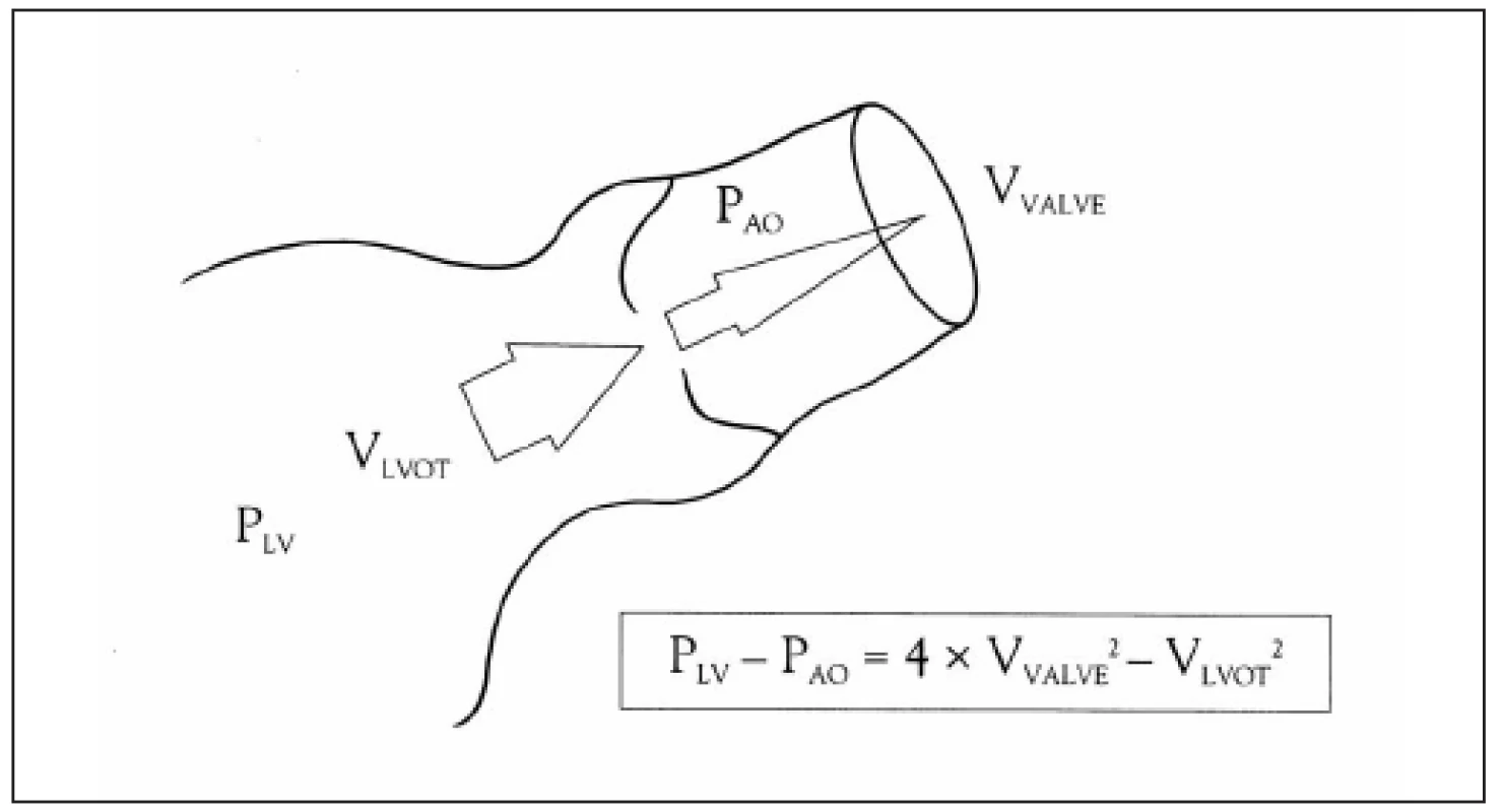 Diagram ukazuje teorii měření transvalvulárních gradientů vtokových rychlostí jetu s použitím Bernoulliho rovnice.