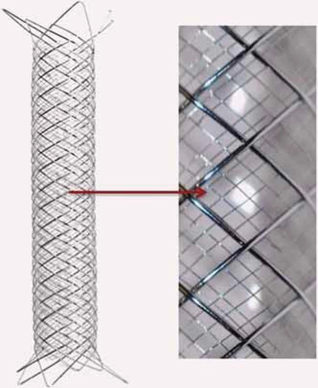Tzv. Double Layer Mesh Stent Technology kombinující samoroztažitelný stent s uzavřenými buňkami s hustou nitinolovou sítí uvnitř stentu, kterou se dociluje optimálního pokrytí aterosklerotické léze.