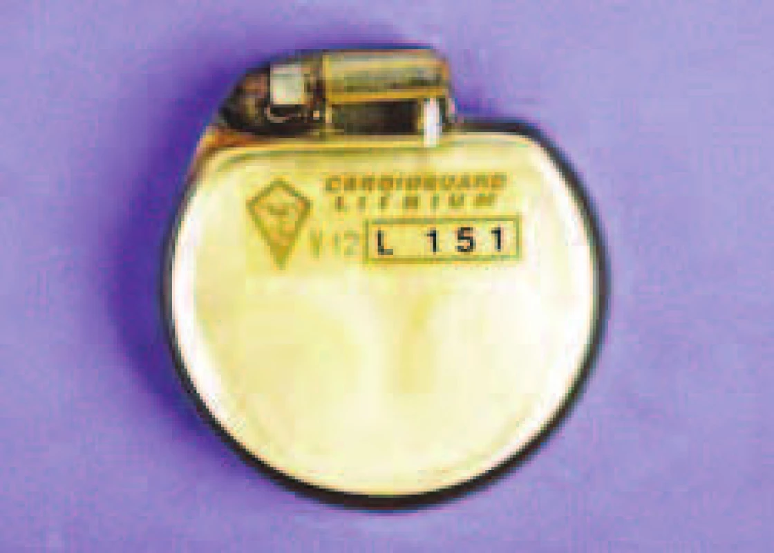 Jeden z prvních kardiostimulátorů vybavený lithium-jodinovou baterií. Tento model (V12-L151 firmy LEM) pochází z Itálie z roku 1975.