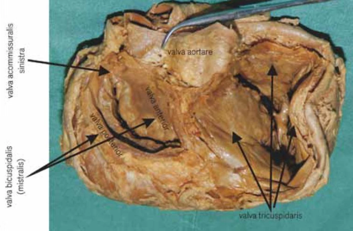 Anatomické poměry (foto archiv autora).