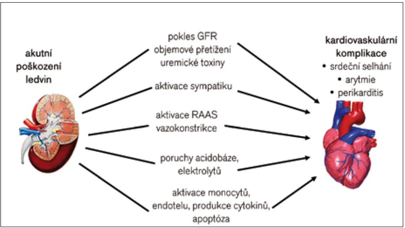 Patofyziologie akutních renokardiálních interakcí.