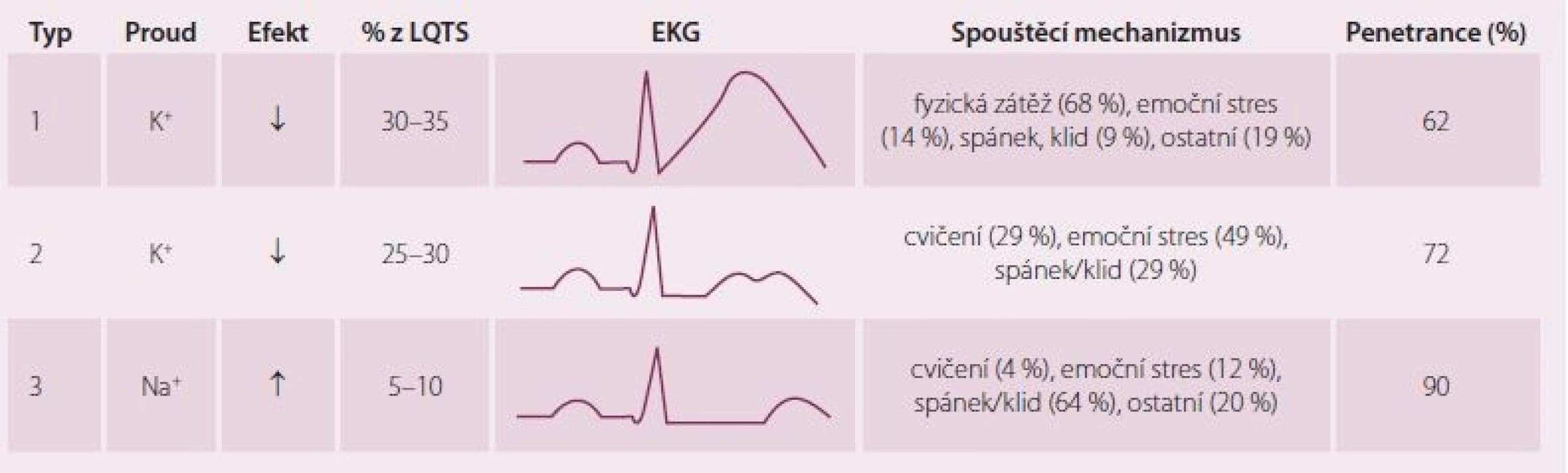 Nejčastější typy syndromu dlouhého QT a jejich EKG manifestace. Upraveno dle [5].