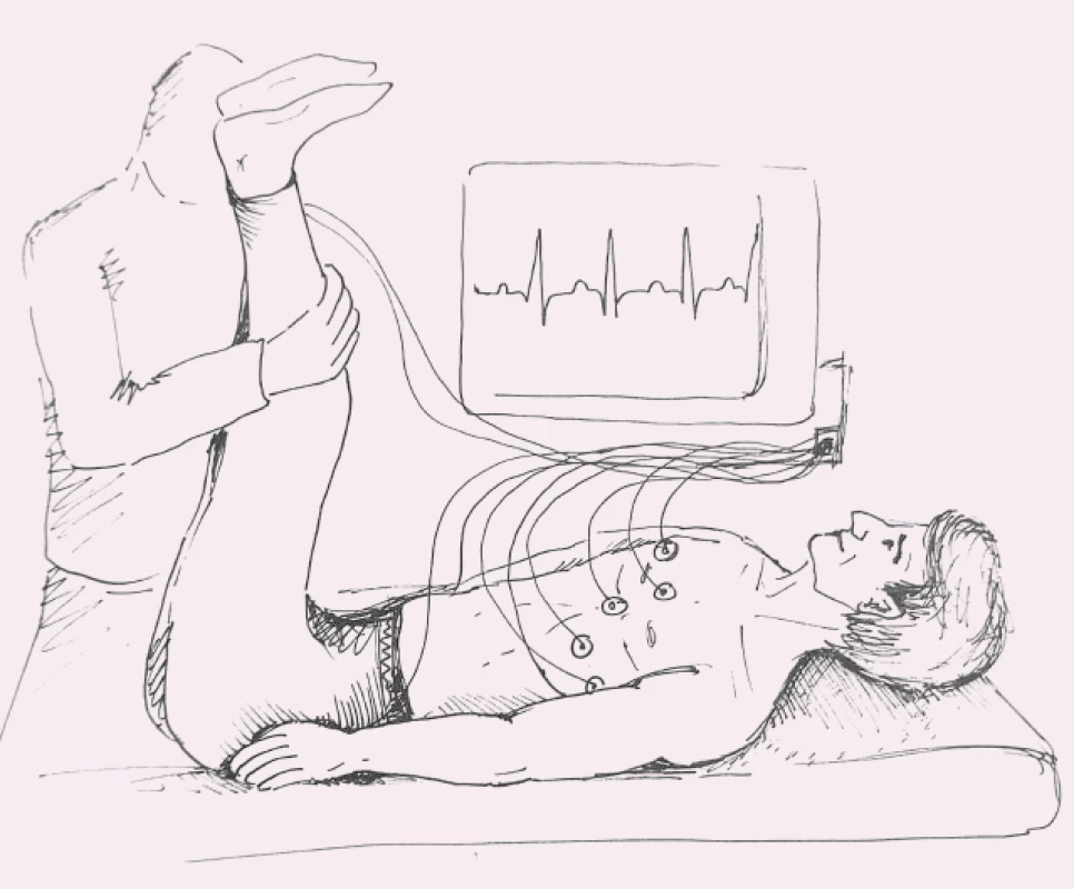 Po přerušeném výdechu je pacientka převedena do Trendelenburgovy polohy
(výška nohou 45° proti podložce) (autor: Radek Benda).